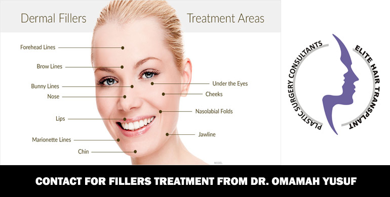 fillers-treatment-in-islamabad